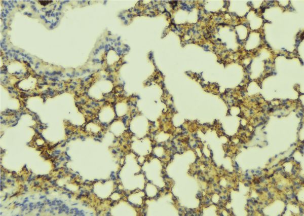 CHRNA1 Antibody - 1:100 staining mouse lung tissue by IHC-P. The sample was formaldehyde fixed and a heat mediated antigen retrieval step in citrate buffer was performed. The sample was then blocked and incubated with the antibody for 1.5 hours at 22°C. An HRP conjugated goat anti-rabbit antibody was used as the secondary.