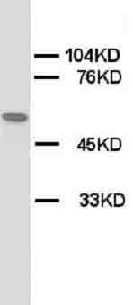 CHRNA1 Antibody -  This image was taken for the unconjugated form of this product. Other forms have not been tested.