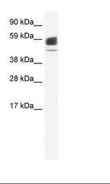 CHRNA1 Antibody - Fetal Kidney Lysate.  This image was taken for the unconjugated form of this product. Other forms have not been tested.