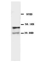 CHRNA1 Antibody -  This image was taken for the unconjugated form of this product. Other forms have not been tested.