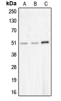 CHRNA10 Antibody - Western blot analysis of CHRNA10 expression in MDAMB453 (A); NCIH292 (B); COLO205 (C) whole cell lysates.