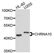 CHRNA10 Antibody - Western blot analysis of extracts of various cells.