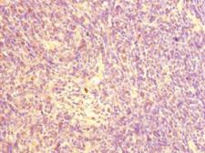 CHRNA10 Antibody - Immunohistochemistry of paraffin-embedded human thymus tissue at dilution 1:100