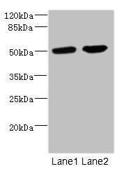 CHRNA10 Antibody - Western blot All Lanes: CHRNA10 antibody at 0.57ug/ml Lane 1: Jurkat whole cell lysate Lane 2: A549 whole cell lysate Secondary Goat polyclonal to rabbit IgG at 1/10000 dilution Predicted band size: 50 kDa Observed band size: 50 kDa