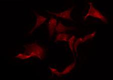 CHRNA10 Antibody - Staining HeLa cells by IF/ICC. The samples were fixed with PFA and permeabilized in 0.1% Triton X-100, then blocked in 10% serum for 45 min at 25°C. The primary antibody was diluted at 1:200 and incubated with the sample for 1 hour at 37°C. An Alexa Fluor 594 conjugated goat anti-rabbit IgG (H+L) Ab, diluted at 1/600, was used as the secondary antibody.