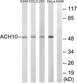 CHRNA10 Antibody - Western blot analysis of extracts from A549 cells, COLO cells, HeLa cells and 293 cells, using CHRNA10 antibody.