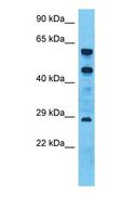 CHRNA10 Antibody - Western blot of CHRNA10 Antibody with human 721_B Whole Cell lysate.  This image was taken for the unconjugated form of this product. Other forms have not been tested.