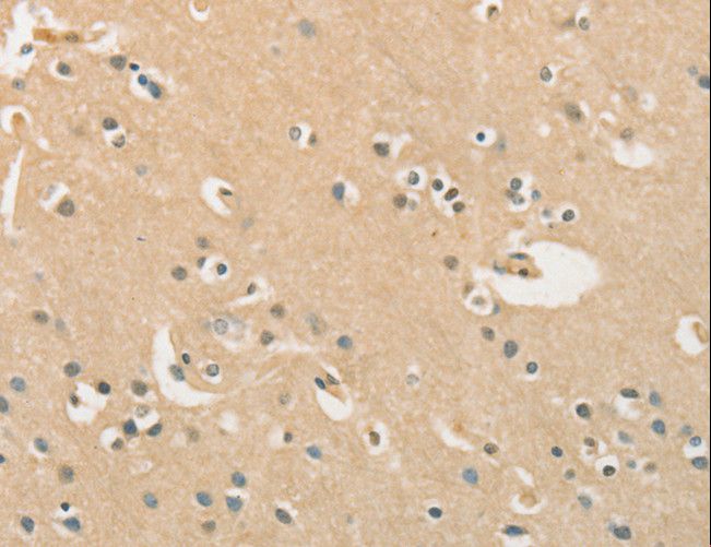 CHRNA2 Antibody - Immunohistochemistry of paraffin-embedded Human brain using CHRNA2 Polyclonal Antibody at dilution of 1:40.