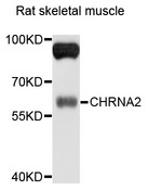 CHRNA2 Antibody - Western blot analysis of extracts of rat skeletal muscle, using CHRNA2 antibody at 1:1000 dilution. The secondary antibody used was an HRP Goat Anti-Rabbit IgG (H+L) at 1:10000 dilution. Lysates were loaded 25ug per lane and 3% nonfat dry milk in TBST was used for blocking. An ECL Kit was used for detection and the exposure time was 10s.
