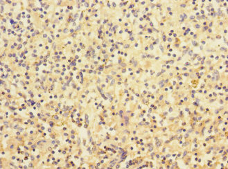 CHRNA2 Antibody - Immunohistochemistry of paraffin-embedded human spleen tissue at dilution 1:100