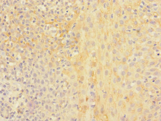 CHRNA2 Antibody - Immunohistochemistry of paraffin-embedded human tonsil tissue at dilution 1:100