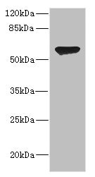CHRNA2 Antibody - Western blot All Lanes: CHRNA2antibody IgG at 2.41ug/ml+ HL60 whole cell lysate Secondary Goat polyclonal to rabbit IgG at 1/10000 dilution Predicted band size: 60,59 kDa Observed band size: 60 kDa