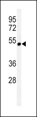 CHRNA3 Antibody - Western blot of CHRNA3 Antibody in CEM cell line lysates (35 ug/lane). CHRNA3 (arrow) was detected using the purified antibody.