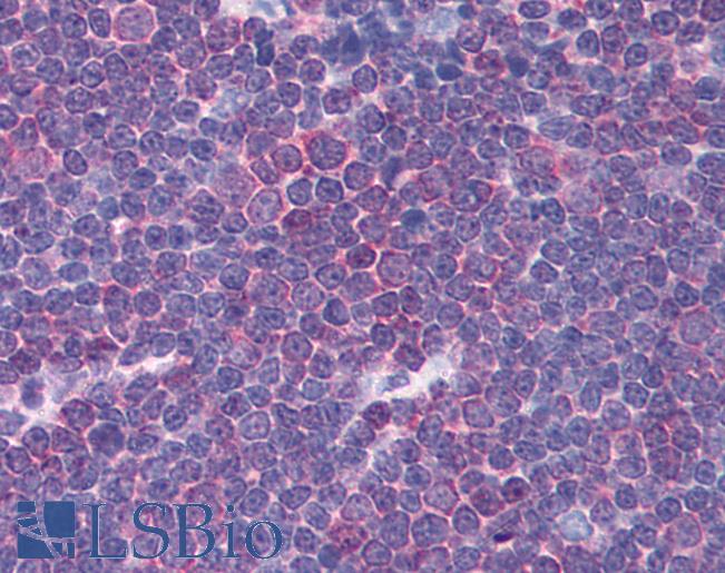 CHRNA3 Antibody - Anti-CHRNA3 antibody IHC of human thymus. Immunohistochemistry of formalin-fixed, paraffin-embedded tissue after heat-induced antigen retrieval. Antibody concentration 5 ug/ml.  This image was taken for the unconjugated form of this product. Other forms have not been tested.
