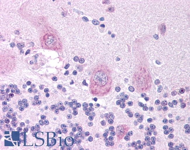 CHRNA3 Antibody - Anti-CHRNA3 antibody IHC of human brain, cerebellum. Immunohistochemistry of formalin-fixed, paraffin-embedded tissue after heat-induced antigen retrieval. Antibody concentration 5 ug/ml.  This image was taken for the unconjugated form of this product. Other forms have not been tested.