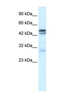 CHRNA3 Antibody - CHRNA3 antibody Western blot of Fetal Thymus lysate. Antibody concentration 1 ug/ml. This image was taken for the unconjugated form of this product. Other forms have not been tested.