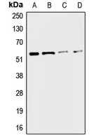 CHRNA3 Antibody - Western blot analysis of CHRNA3 expression in A549 (A); HepG2 (B); mouse liver (C); rat kidney (D) whole cell lysates.