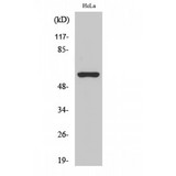 CHRNA3 Antibody - Western blot of AChRalpha3 antibody