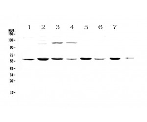 CHRNA3 Antibody - Western blot analysis of CHRNA3 using anti-CHRNA3 antibody