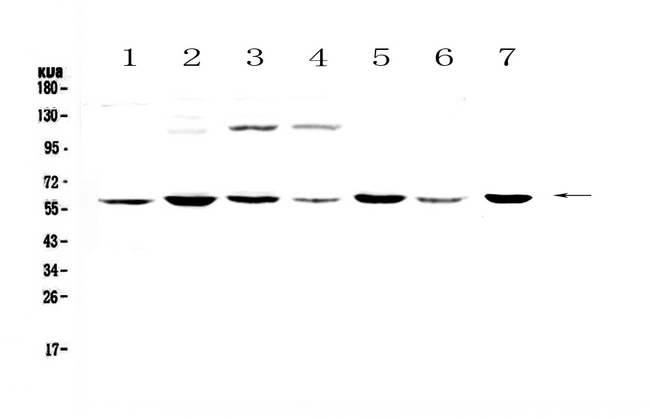 CHRNA3 Antibody - Western blot analysis of CHRNA3 using anti-CHRNA3 antibody. Electrophoresis was performed on a 5-20% SDS-PAGE gel at 70V (Stacking gel) / 90V (Resolving gel) for 2-3 hours. The sample well of each lane was loaded with 50ug of sample under reducing conditions. Lane 1: human Hela whole cell lysates,Lane 2: human MDA-MB-453 whole cell lysates,Lane 3: human Jurkat whole cell lysates,Lane 4: human HepG2 whole cell lysates,Lane 5: human SK-OV-3 whole cell lysates,Lane 6: human PANC-1 whole cell lysates,Lane 7: mouse thymus tissue lysates. After Electrophoresis, proteins were transferred to a Nitrocellulose membrane at 150mA for 50-90 minutes. Blocked the membrane with 5% Non-fat Milk/ TBS for 1.5 hour at RT. The membrane was incubated with rabbit anti-CHRNA3 antigen affinity purified polyclonal antibody at 0.5 µg/mL overnight at 4°C, then washed with TBS-0.1% Tween 3 times with 5 minutes each and probed with a goat anti-rabbit IgG-HRP secondary antibody at a dilution of 1:10000 for 1.5 hour at RT. The signal is developed using an Enhanced Chemiluminescent detection (ECL) kit with Tanon 5200 system. A specific band was detected for CHRNA3 at approximately 60KD. The expected band size for CHRNA3 is at 57KD.