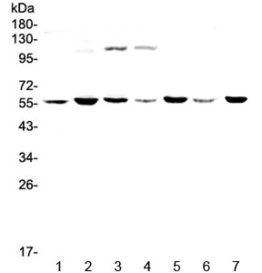 CHRNA3 Antibody - Western blot testing of human 1) HeLa, 2) MDA-MB-453, 3) Jurkat, 4) HepG2, 5) SK-OV-3, 6) PANC-1 and 7) mouse thymus lysate with CHRNA3 antibody at 0.5ug/ml. Predicted molecular weight ~57 kDa.