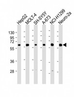 CHRNA4 / NACHR Antibody - All lanes: Anti-CHRNA4 Antibody (N-Term) at 1:2000 dilution. Lane 1: HepG2 whole cell lysate. Lane 2: MOLT-4 whole cell lysate. Lane 3: SH-SY5Y whole cell lysate. Lane 4: A-673 whole cell lysate. Lane 5: NCI-H1299 whole cell lysate. Lane 6: Neuro-2a whole cell lysate Lysates/proteins at 20 ug per lane. Secondary Goat Anti-Rabbit IgG, (H+L), Peroxidase conjugated at 1:10000 dilution. Predicted band size: 70 kDa. Blocking/Dilution buffer: 5% NFDM/TBST.