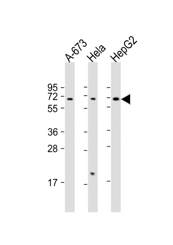 CHRNA4 / NACHR Antibody - All lanes: Anti-CHRNA4 Antibody (C-Term) at 1:2000 dilution. Lane 1: A-673 whole cell lysate. Lane 2: HeLa whole cell lysate. Lane 3: HepG2 whole cell lysate Lysates/proteins at 20 ug per lane. Secondary Goat Anti-Rabbit IgG, (H+L), Peroxidase conjugated at 1:10000 dilution. Predicted band size: 70 kDa. Blocking/Dilution buffer: 5% NFDM/TBST.