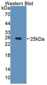 CHRNA4 / NACHR Antibody - Western blot of CHRNA4 / NACHR antibody.