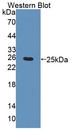 CHRNA4 / NACHR Antibody - Western blot of CHRNA4 / NACHR antibody.