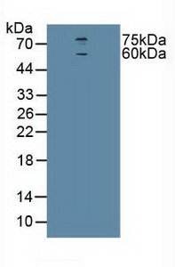 CHRNA4 / NACHR Antibody - Western Blot; Sample: Human U-87MG Cells.