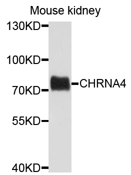 CHRNA4 / NACHR Antibody - Western blot analysis of extracts of mouse kidney, using CHRNA4 antibody at 1:1000 dilution. The secondary antibody used was an HRP Goat Anti-Rabbit IgG (H+L) at 1:10000 dilution. Lysates were loaded 25ug per lane and 3% nonfat dry milk in TBST was used for blocking. An ECL Kit was used for detection and the exposure time was 60s.