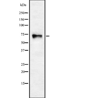 CHRNA4 / NACHR Antibody - Western blot analysis of CHRNA4 using HuvEc whole cells lysates