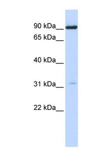 CHRNA4 / NACHR Antibody - CHRNA4 antibody Western blot of HepG2 Cell lysate. Antibody concentration 1 ug/ml. This image was taken for the unconjugated form of this product. Other forms have not been tested.