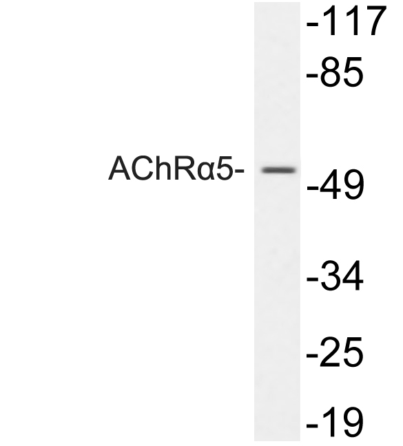 CHRNA5 Antibody - Western blot analysis of lysates from 293 cells, using AChRÎ±5 antibody.