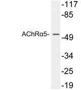 CHRNA5 Antibody - Western blot analysis of lysates from 293 cells, using AChRÎ±5 antibody.