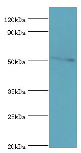 CHRNA5 Antibody - Western blot. All lanes: Neuronal acetylcholine receptor subunit alpha-5 antibody at 12 ug/ml+Jurkat whole cell lysate. Secondary antibody: Goat polyclonal to rabbit at 1:10000 dilution. Predicted band size: 53 kDa. Observed band size: 53 kDa.