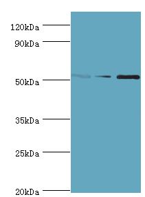CHRNA5 Antibody - Western blot. All lanes: Neuronal acetylcholine receptor subunit alpha-5 antibody at 12 ug/ml. Lane 1: Jurkat whole cell lysate. Lane 2: A431 whole cell lysate. Lane 3: A549 whole cell lysate. secondary Goat polyclonal to rabbit at 1:10000 dilution. Predicted band size: 53 kDa. Observed band size: 53 kDa.