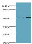 CHRNA5 Antibody - Western blot. All lanes: Neuronal acetylcholine receptor subunit alpha-5 antibody at 12 ug/ml. Lane 1: Jurkat whole cell lysate. Lane 2: A431 whole cell lysate. Lane 3: A549 whole cell lysate. secondary Goat polyclonal to rabbit at 1:10000 dilution. Predicted band size: 53 kDa. Observed band size: 53 kDa.
