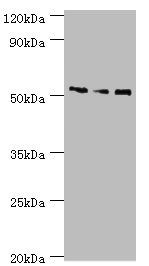 CHRNA5 Antibody - Western blot All lanes: Neuronal acetylcholine receptor subunit alpha-5 antibody at 12µg/ml Lane 1: Jurkat whole cell lysate Lane 2: A431 whole cell lysate Lane 3: A549 whole cell lysate Secondary Goat polyclonal to rabbit IgG at 1/10000 dilution Predicted band size: 53 kDa Observed band size: 53 kDa