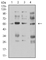 CHRNA5 Antibody - Western blot analysis using CHRNA5 mouse mAb against membrane protein lysate of C6 (1), membrane protein lysate of SK-N-SH (2), membrane protein lysate of C6 (3), and C6 (4) cell lysate.