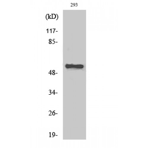 CHRNA5 Antibody - Western blot of AChRalpha5 antibody
