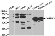 CHRNA5 Antibody - Western blot analysis of extracts of various cell lines, using CHRNA5 antibody at 1:1000 dilution. The secondary antibody used was an HRP Goat Anti-Rabbit IgG (H+L) at 1:10000 dilution. Lysates were loaded 25ug per lane and 3% nonfat dry milk in TBST was used for blocking.