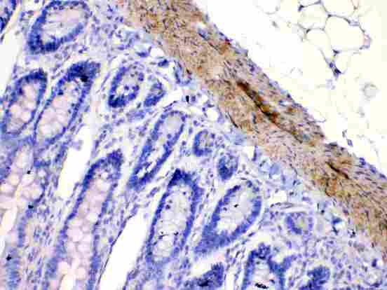 CHRNA5 Antibody - CHRNA5 was detected in paraffin-embedded sections of rat intestine tissues using rabbit anti- CHRNA5 Antigen Affinity purified polyclonal antibody