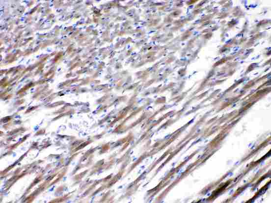 CHRNA5 Antibody - CHRNA5 was detected in paraffin-embedded sections of rat cardiac muscle tissues using rabbit anti- CHRNA5 Antigen Affinity purified polyclonal antibody