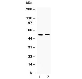 CHRNA5 Antibody - Western blot testing of 1) rat skeletal muscle and 2) human HepG2 lysate with CHRNA5 antibody at 0.5ug/ml. Predicted molecular weight ~53 kDa.