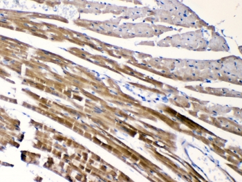 CHRNA5 Antibody - IHC testing of FFPE mouse heart tissue with CHRNA5 antibody at 1ug/ml. Required HIER: steam section in pH6 citrate buffer for 20 min and allow to cool prior to testing.