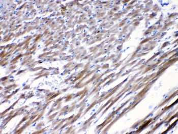 CHRNA5 Antibody - IHC testing of FFPE rat heart tissue with CHRNA5 antibody at 1ug/ml. Required HIER: steam section in pH6 citrate buffer for 20 min and allow to cool prior to testing.