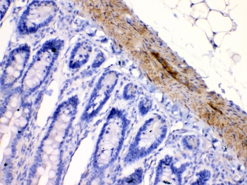 CHRNA5 Antibody - IHC testing of FFPE rat intestine tissue with CHRNA5 antibody at 1ug/ml. Required HIER: steam section in pH6 citrate buffer for 20 min and allow to cool prior to testing.