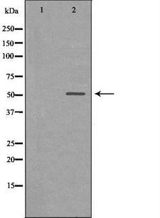 CHRNA5 Antibody - Western blot analysis of extracts of mouse brain tissue using CHRNA5 antibody. The lane on the left is treated with the antigen-specific peptide.