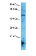 CHRNA6 Antibody - Western blot of ACHA6 Antibody with human Fetal Kidney lysate.  This image was taken for the unconjugated form of this product. Other forms have not been tested.